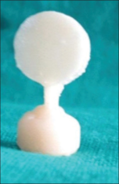 A comparative evaluation of the variations on the shades of pressable ceramic system with the layering technique after different number of firing cycles: An in vitro study.