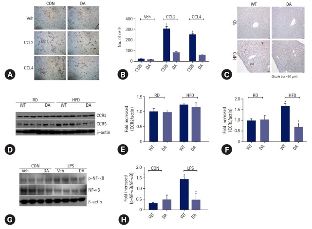 DA-6034 ameliorates hepatic steatosis and inflammation in high fat diet-induced obese mice.