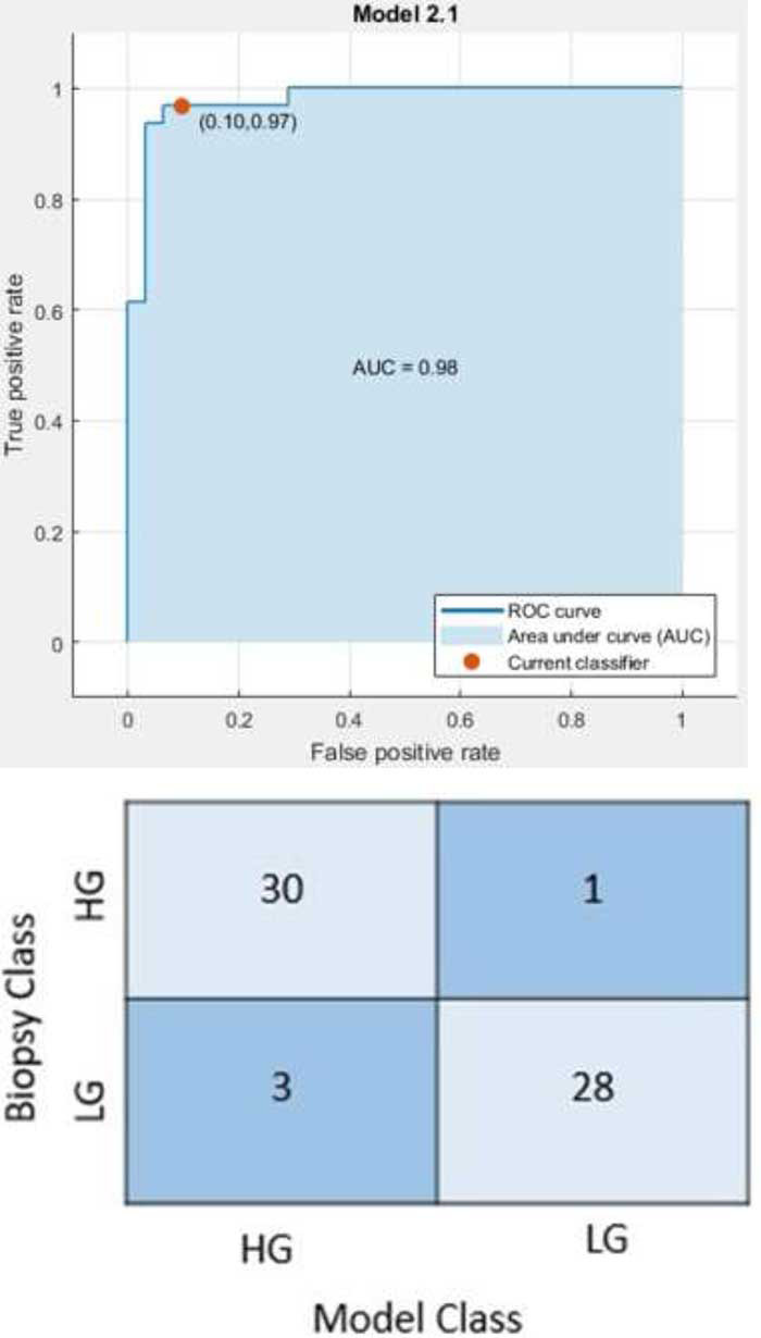 Grading of Gliomas by Contrast-Enhanced CT Radiomics Features.