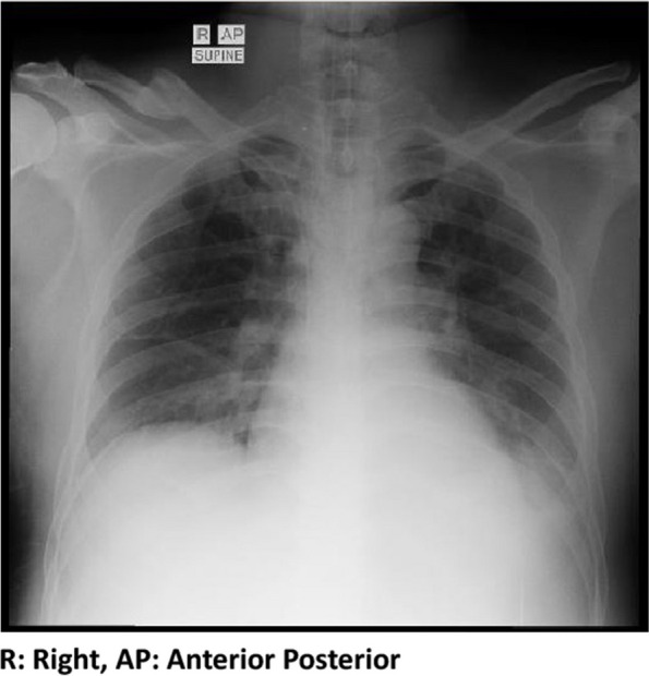 Challenges of diagnosing severe malaria with complications in adult patients: a case report.