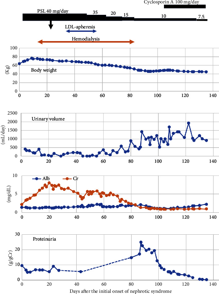 An Elderly Case of Minimal Change Nephrotic Syndrome: Correlation between Renal Tubular Dysfunction and the Onset of Oliguric Acute Kidney Injury Requiring Hemodialysis.