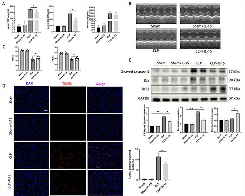 Pretreatment with interleukin-15 attenuates inflammation and apoptosis by inhibiting NF-κB signaling in sepsis-induced myocardial dysfunction.