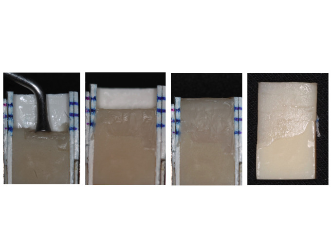 Effect of different design and surface treatment on the load-to-failure of ceramic repaired with composite.