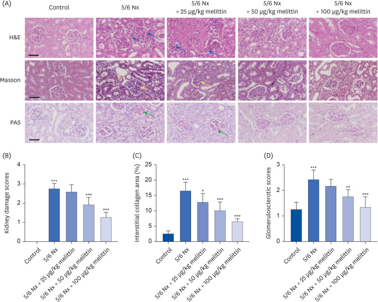 Melittin induces autophagy to alleviate chronic renal failure in 5/6-nephrectomized rats and angiotensin II-induced damage in podocytes.