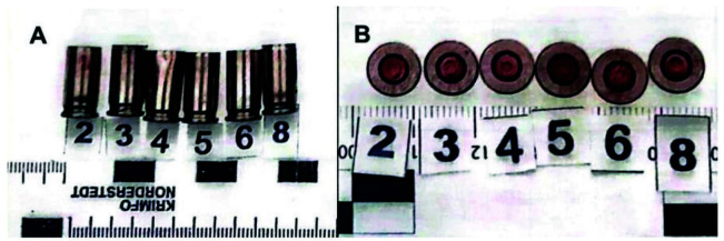 CIVILIAN GUNSHOT VICTIM WITH LOW-ENERGY BULLET INJURIES TO LOWER EXTREMITIES AND ATYPICAL LEFT DISTAL FEMUR FRACTURE: A CASE REPORT.