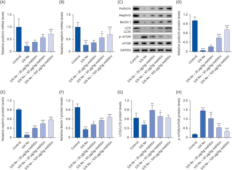 Melittin induces autophagy to alleviate chronic renal failure in 5/6-nephrectomized rats and angiotensin II-induced damage in podocytes.