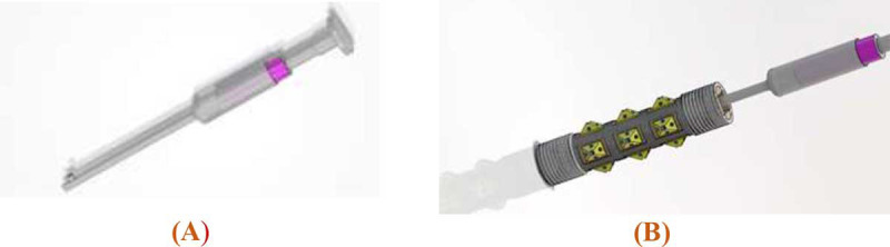 Modeling of a New Percutaneous Orthopedic Implant System to Control the Post-surgery Osseointegration Process.