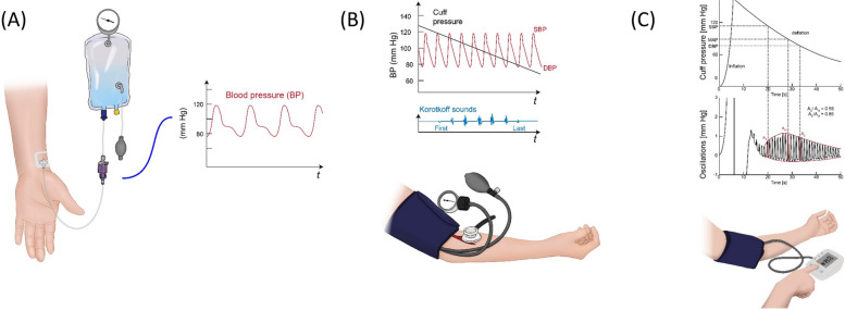 History and evolution of blood pressure measurement.