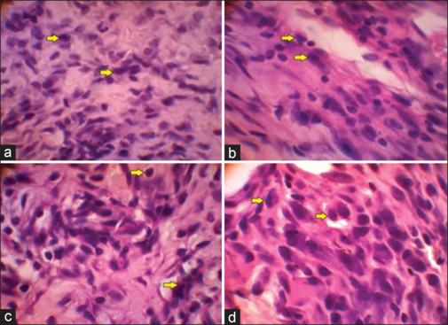 Efficacy of Topical Application of Chum Salmon (<i>Oncorhynchus keta</i>) Skin-derived Collagen Extracts in Improving Oral Traumatic Ulcer Healing.