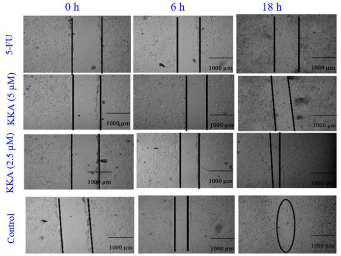 Evaluation of <i>in vitro</i> and <i>in vivo</i> anticancer activities of potassium koetjapate: a solubility improved formulation of koetjapic acid against human colon cancer.