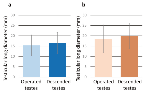 Evaluation of testicular stiffness in boys with unilateral cryptorchidism after orchiopexy by ultrasound strain elastography.