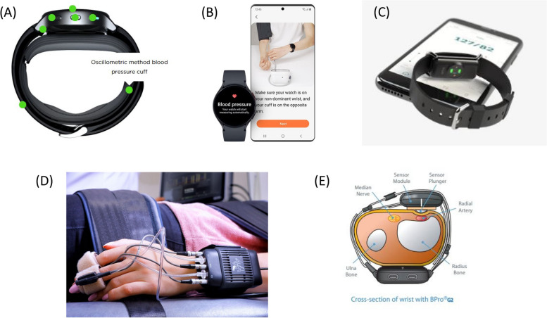 History and evolution of blood pressure measurement.