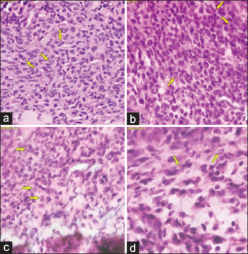Efficacy of Topical Application of Chum Salmon (<i>Oncorhynchus keta</i>) Skin-derived Collagen Extracts in Improving Oral Traumatic Ulcer Healing.