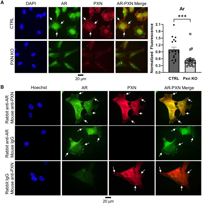 Paxillin regulates androgen receptor expression associated with granulosa cell focal adhesions.