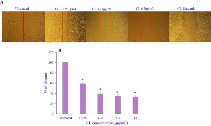 <i>Curcuma longa</i> extract inhibits migration by reducing MMP-9 and Rac-1 expression in highly metastatic breast cancer cells.