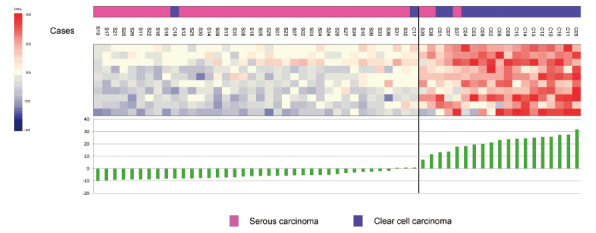 Differentiation of ovarian serous carcinoma from ovarian clear cell carcinoma using a 10-gene signature selected by comprehensive gene expression analysis.