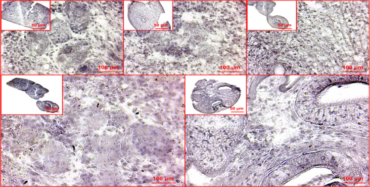 Comparative Analysis of <i>Nanos</i> and <i>Ago</i> Genes Expression in the Germinative Cells Isolated from Germinal Layer and the Neck Region of <i>Echinococcus granulosus</i>.