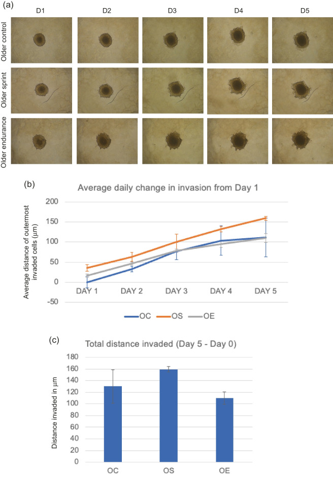 Erratum: Publisher Correction: The protective effect of endurance running against the pro-invasive effects of ageing in breast cancer cells and mesenchymal stem cells in vitro.