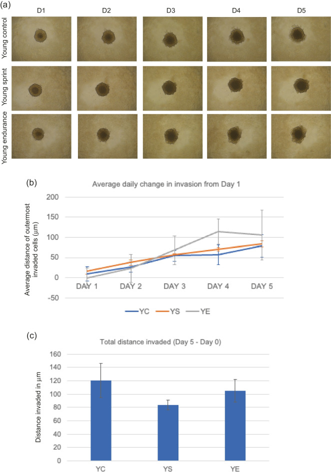 Erratum: Publisher Correction: The protective effect of endurance running against the pro-invasive effects of ageing in breast cancer cells and mesenchymal stem cells in vitro.