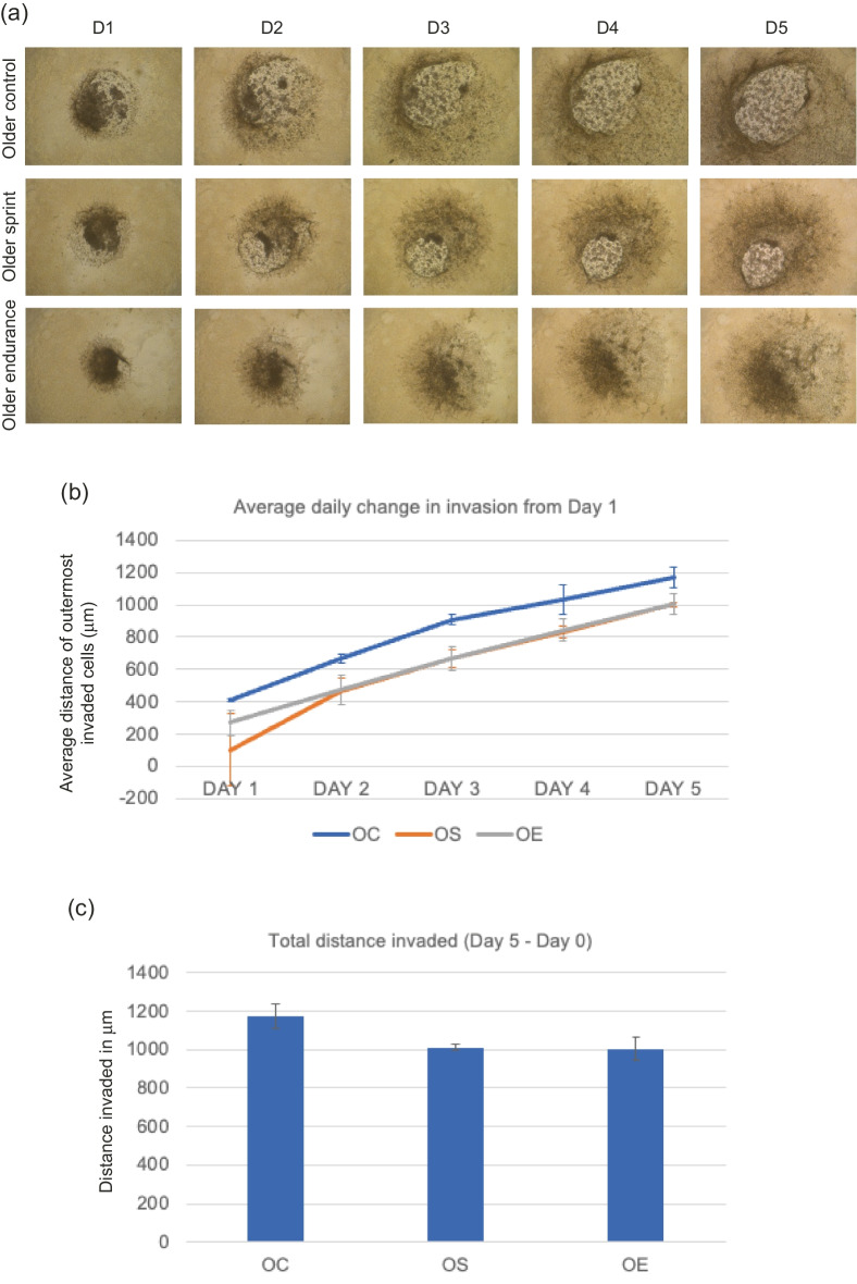 Erratum: Publisher Correction: The protective effect of endurance running against the pro-invasive effects of ageing in breast cancer cells and mesenchymal stem cells in vitro.