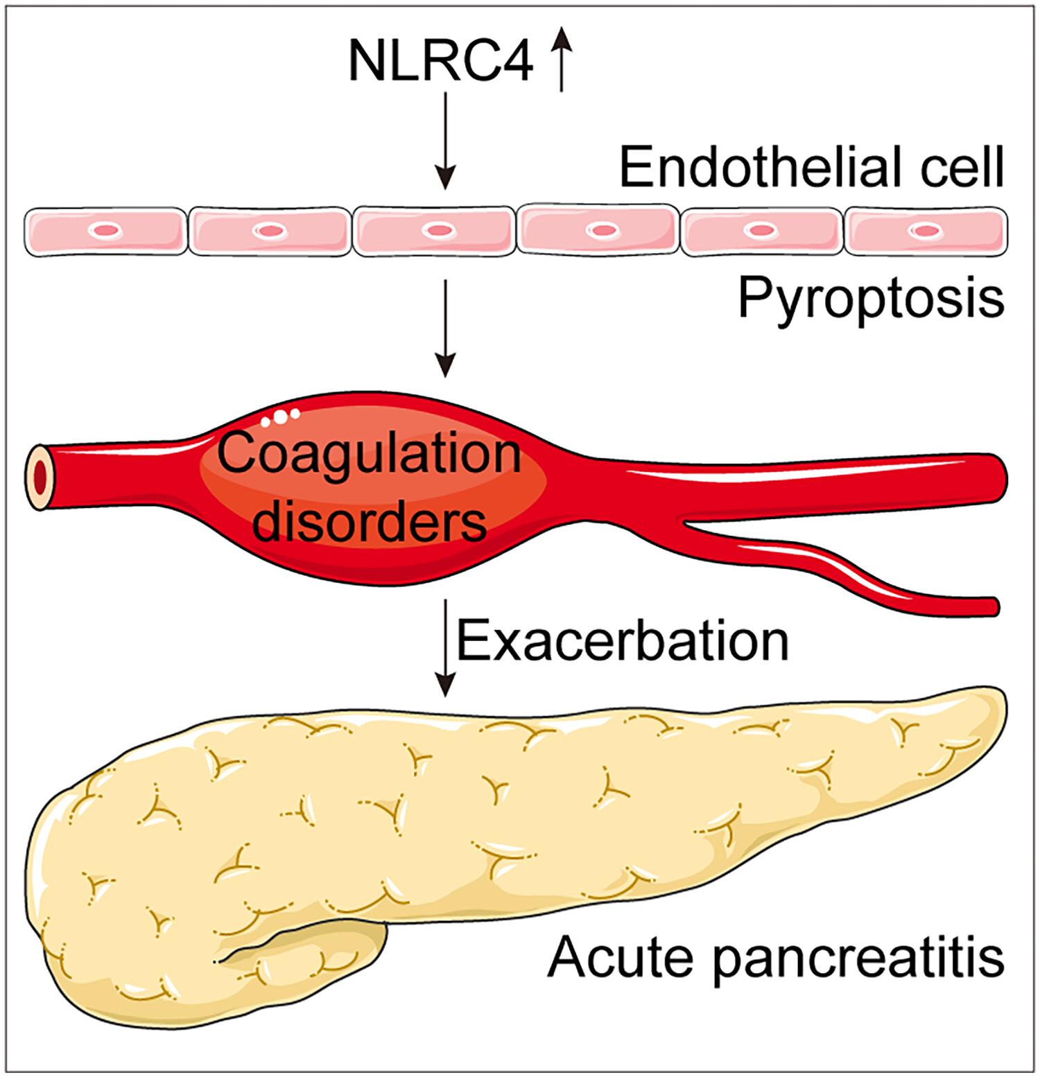 NLRC4-mediated pyroptosis was involved in coagulation disorders of acute pancreatitis