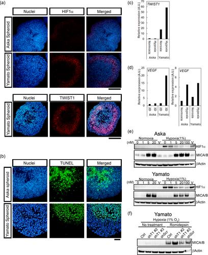 Improvement of histone deacetylase inhibitor efficacy by SN38 through TWIST1 suppression in synovial sarcoma