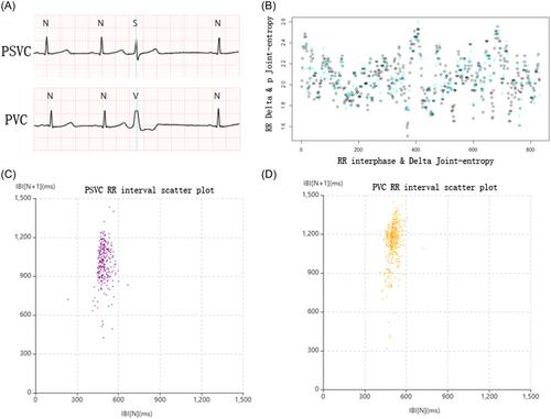 The diagnostic efficiency of artificial intelligence based 2 hours Holter monitoring in premature ventricular and supraventricular contractions detection