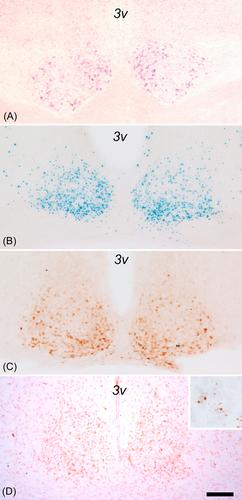 Thirty-seven years of MT1 and MT2 melatonin receptor localization in the brain: Past and future challenges