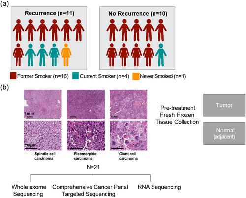 Integrative genomic and transcriptomic profiling of pulmonary sarcomatoid carcinoma identifies molecular subtypes associated with distinct immune features and clinical outcomes