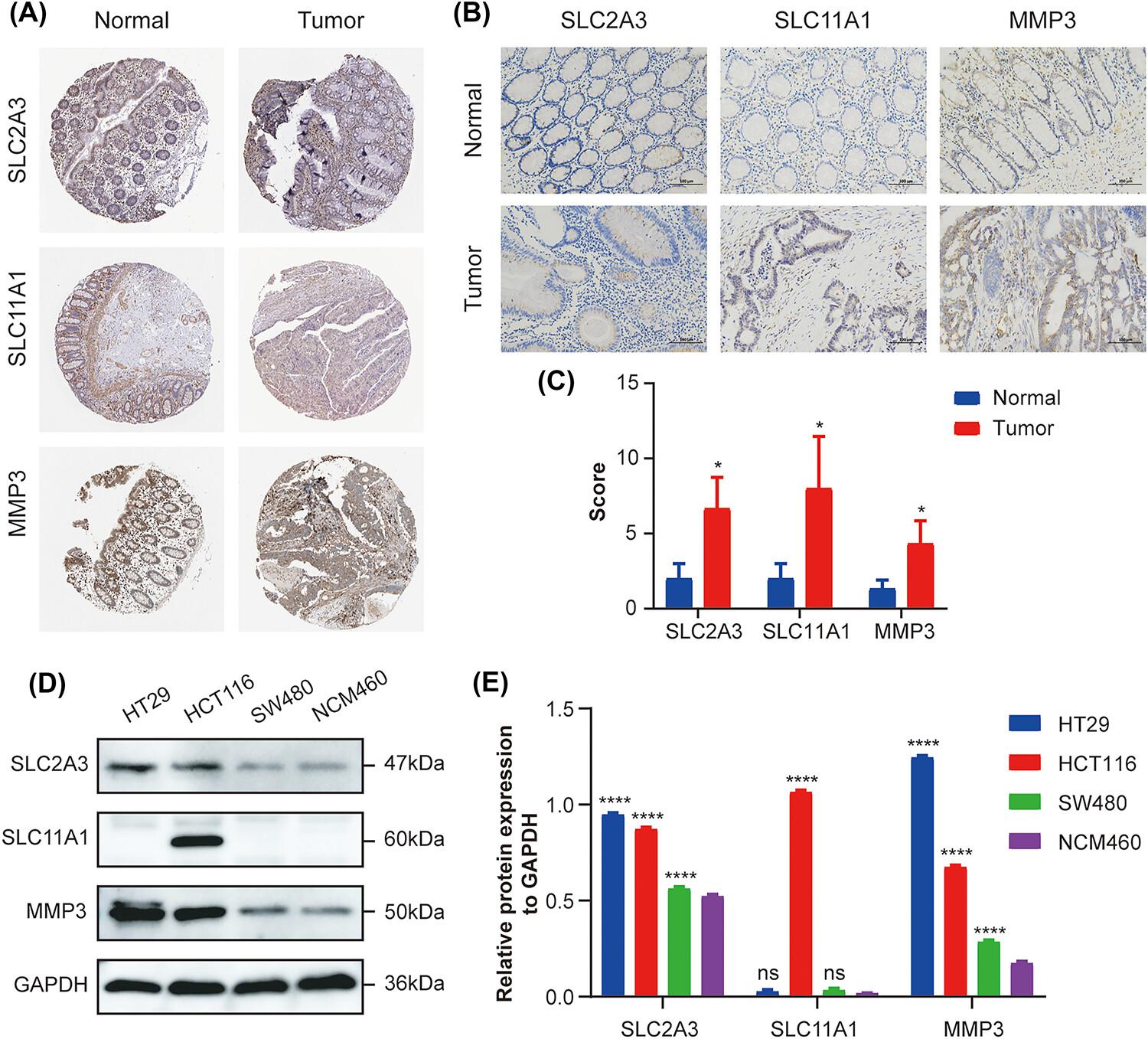 Constructing and validating a risk model based on neutrophil-related genes for evaluating prognosis and guiding immunotherapy in colon cancer