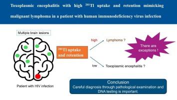 Toxoplasmic encephalitis with high 201Tl uptake and retention mimicking malignant lymphoma in a patient with human immunodeficiency virus infection