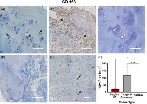 Characterization and modulation of the pro-inflammatory effects of immune cells in the canine intervertebral disk