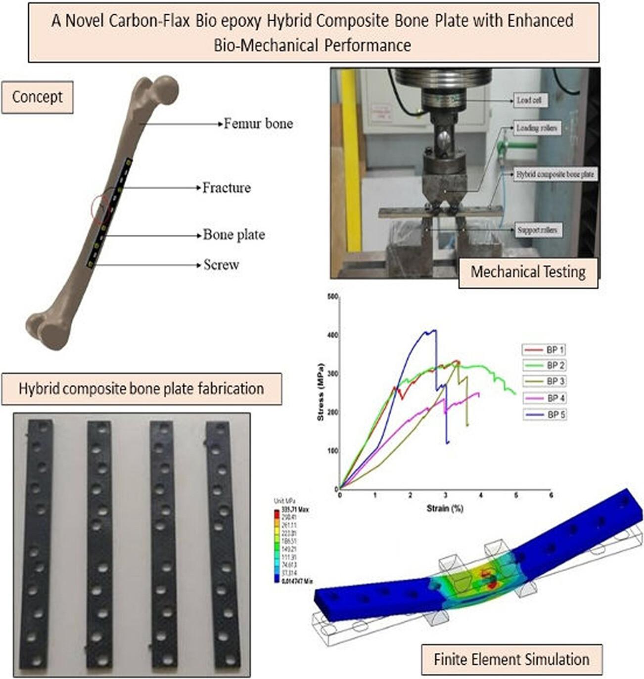 A novel carbon-flax bioepoxy hybrid composite bone plate with enhanced bio-mechanical performance
      Eine neuartige Kohlenstoff-Flachs-Bioepoxid-Hybrid-Verbundwerkstoffknochenplatte mit verbessertem biomechanischen Verhalten