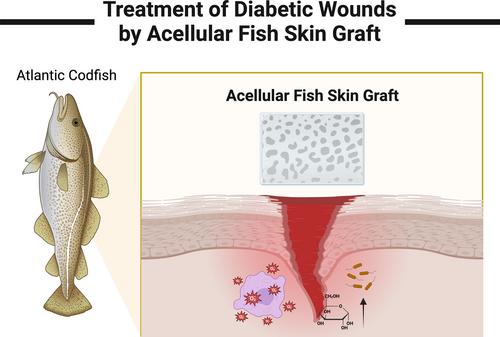 Acellular fish skin grafts in the treatment of diabetic wounds: Advantages and clinical translation