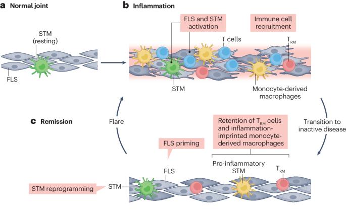 Joint-specific memory, resident memory T cells and the rolling window of opportunity in arthritis