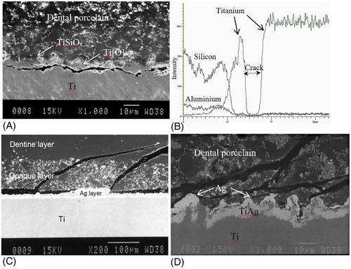 Bonding of ceramics to silver-coated titanium—A combined theoretical and experimental study