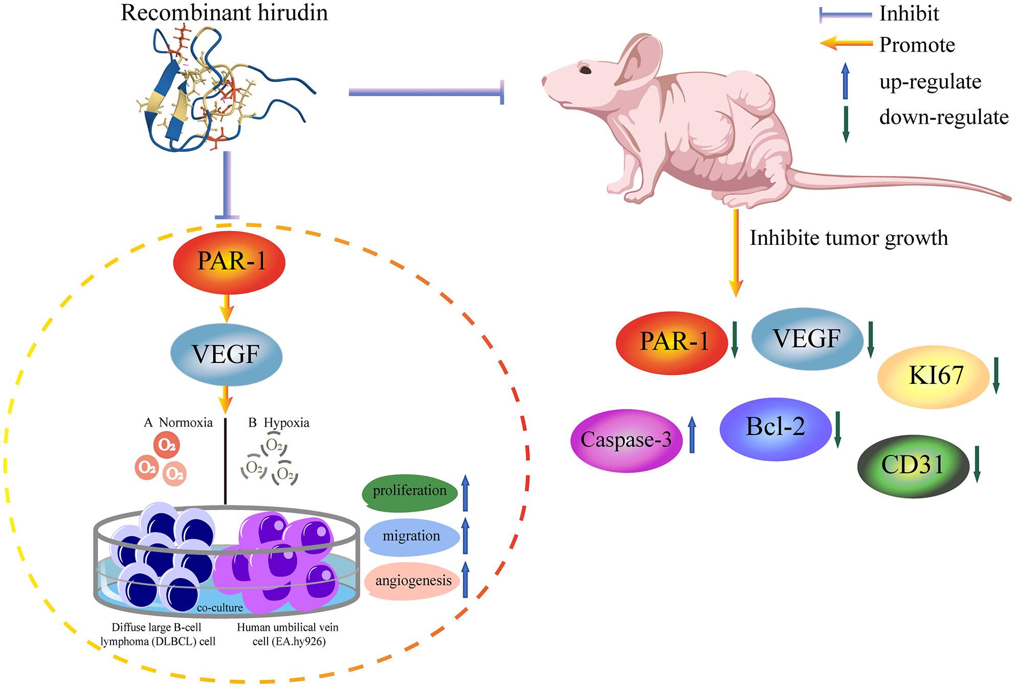 Recombinant hirudin suppresses angiogenesis of diffuse large B-cell lymphoma through regulation of the PAR-1-VEGF