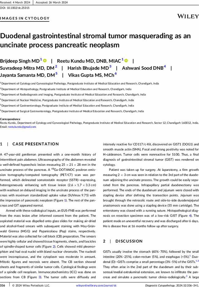 Duodenal gastrointestinal stromal tumor masquerading as an uncinate process pancreatic neoplasm