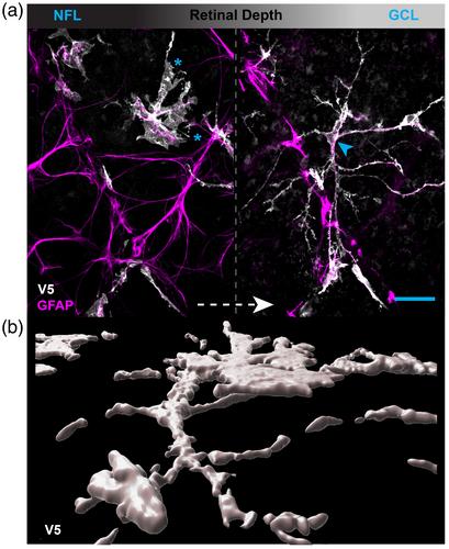 Morphological and electrophysiological characterization of a novel displaced astrocyte in the mouse retina