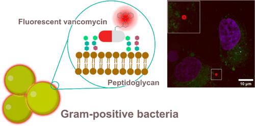 A Far-Red Fluorescent Probe to Visualize Gram-Positive Bacteria in Patient Samples