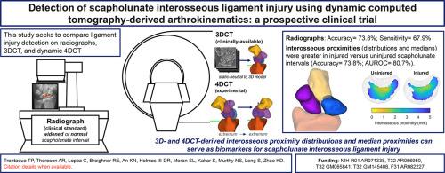 Detection of scapholunate interosseous ligament injury using dynamic computed tomography-derived arthrokinematics: A prospective clinical trial