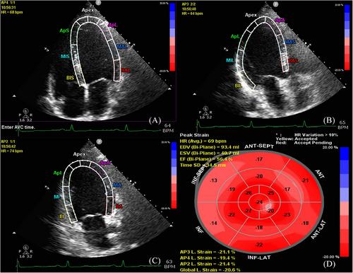 Hypertension-specific association of cardio-ankle vascular index with subclinical left ventricular function in a Chinese population: Danyang study