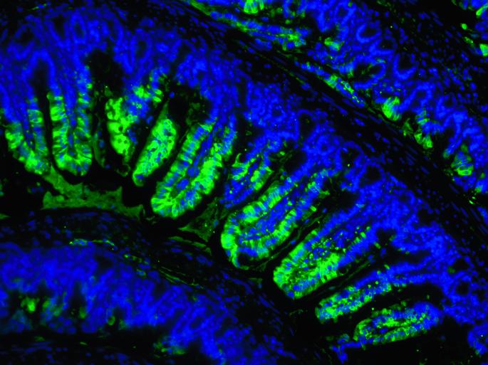 Metformin acts through appetite-suppressing metabolite: Lac-Phe