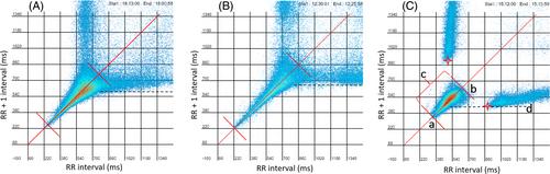 Use of machine learning and Poincaré density grid in the diagnosis of sinus node dysfunction caused by sinoatrial conduction block in dogs