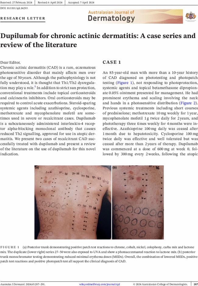 Dupilumab for chronic actinic dermatitis: A case series and review of the literature