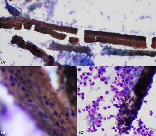 What is your diagnosis? Urine from a horse