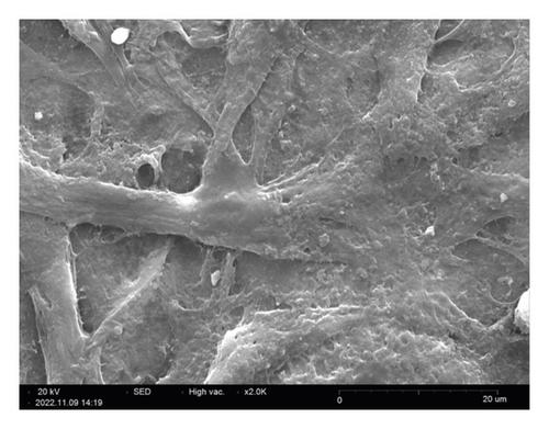 Bilateral Crosslinking with Glutaraldehyde and 1-Ethyl-3-(3-Dimethylaminopropyl) Carbodiimide: An Optimization Strategy for the Application of Decellularized Human Amniotic Membrane in Tissue Engineering