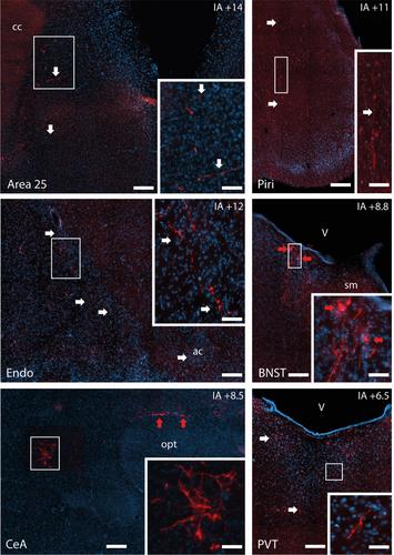 Long-range projections of oxytocin neurons in the marmoset brain