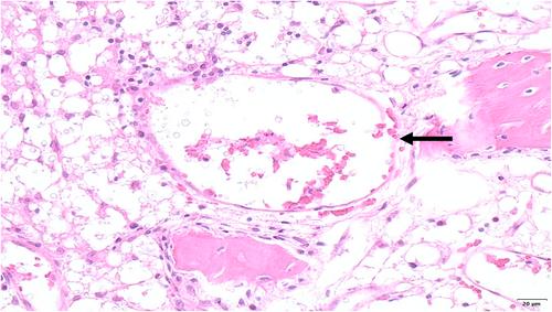 A case of disseminated cryptococcosis with abdominal involvement due to Cryptococcus neoformans species complex in a Ragdoll cat and false-negative cryptococcal antigen lateral flow tests due to the postzone phenomenon