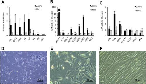 ΔNp73 and its effector targets promote colorectal peritoneal carcinosis and predict survival